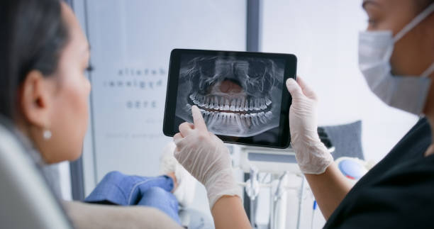 Licensed Tooth Extraction service in South Huntington, NY - Smile Center Dentistry
